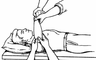 Вывих предплечья: 25% от общего числа вывихов