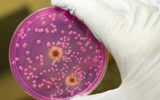 Анальный кандидоз: причины и лечение