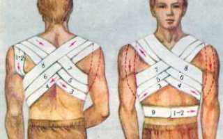 Повязки на грудную клетку