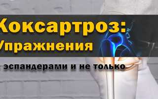Гимнастика доктора Бубновского при коксартрозе тазобедренных суставов
