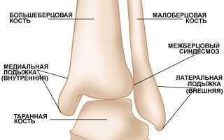 Двухлодыжечный перелом