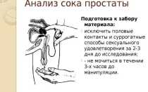 Мазок секрета простаты