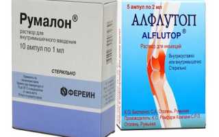 Хондропротекторы при артрозе коленного сустава