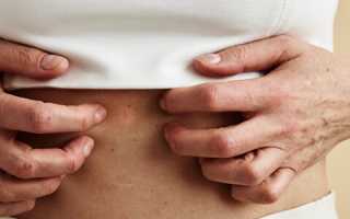 Зуд на животе без сыпи причины