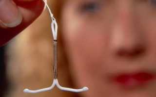 Какая спираль лучше медная или серебряная