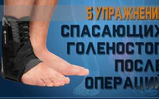 Как разработать ногу после перелома голеностопа