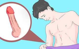 Почему болит половой член после секса? Узнайте причины и решения