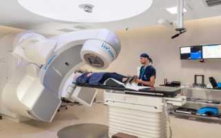 Лучевая терапия при раке груди