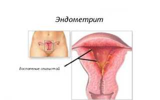 Выделения коричневого цвета у женщин: причины и советы