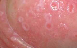 Почему появляется зуд и покраснение на головке? Узнайте причины и решения