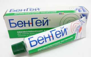 Причины остеоартроза плечевого сустава и методы лечения