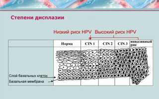 Дегенеративные изменения клеток плоского эпителия