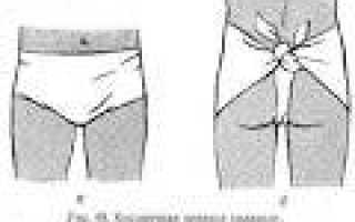 Вывих полового члена