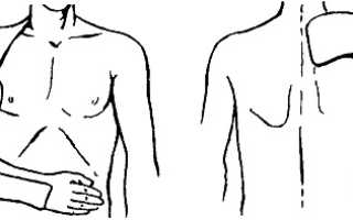 Лонгетная повязка при переломе плечевой кости