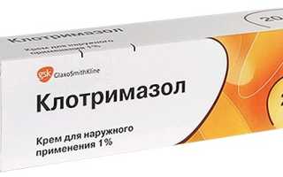 Как лечить лишай у человека в домашних условиях эффективно и безопасно