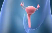 Доброкачественные и злокачественные опухоли яичников