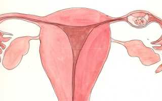 Причины боли в паху и что делать для облегчения