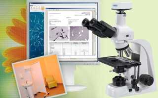 Какие должны быть результаты спермограммы