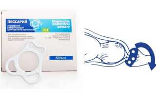 Как определить ицн