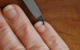 Почему появляются трещины на ногтях рук и как с этим бороться