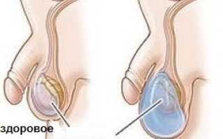 Почему болят яички после возбуждения: причины и советы