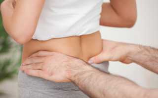 Перелом копчика