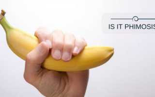 Шелушится кожа на головке члена — все причины и что делать для здоровья