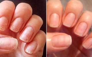 Как укрепить ногти в домашних условиях: советы и рекомендации.