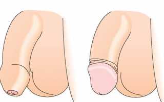 Когда у мальчиков открывается головка? Важные аспекты и советы