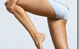 Лечение коксартроза тазобедренного сустава 3 степени