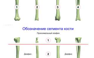 Классификация переломов