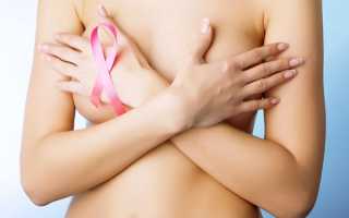 Крупная киста молочной железы