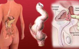 Зуд в заднем проходе у мужчин: причины и лечение