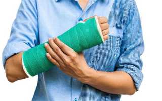 Гипс при переломе руки