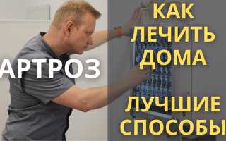 Лечение артроза коленного сустава в домашних условиях