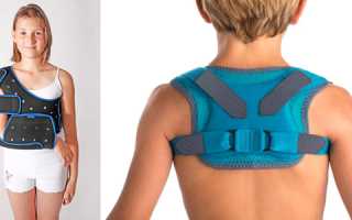 Перелом ключицы у детей