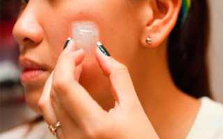 Почему чешется лицо — все причины и возможные решения