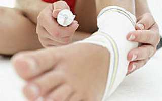 Мазь от вывихов и растяжений