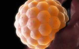 Матка после зачатия до задержки