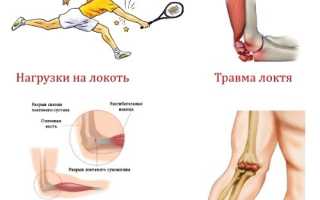 Боль в локтевом суставе. Что делать и как проводить лечение?