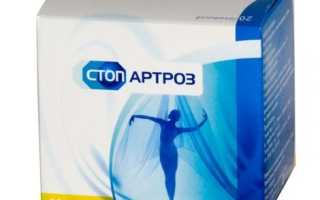 Стопартроз