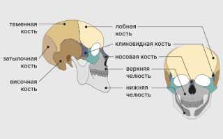 Перелом основания черепа