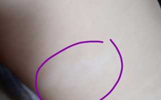 Родимые пятна у новорожденных — какие бывают и как избавиться от них правильно