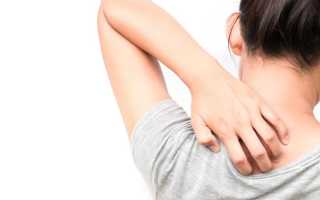 Как отличить чирей от прыща