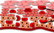 Дистрофия шейки матки