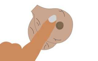 Черные точки на мошонке — опасно или нет? Узнайте мнение врачей