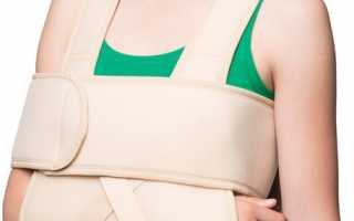 Повязки при переломе плеча