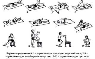 Реабилитация после перелома бедренной кости