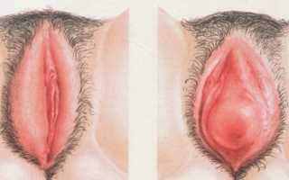 Почему болят половые губы: причины и советы