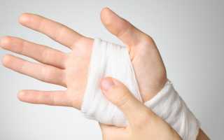 Чем можно обработать рану после пореза для быстрого заживления и профилактики?